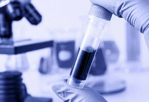 Oligonucleotides Development 