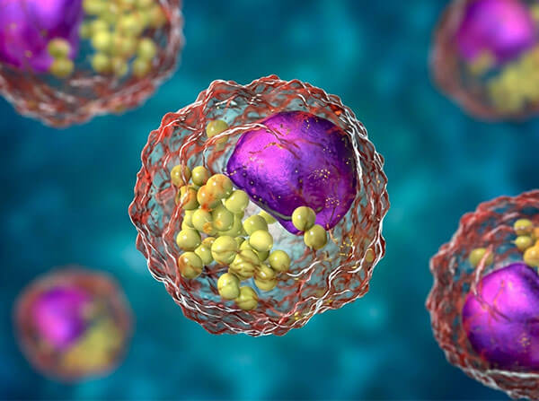 Lipids Custom Development
